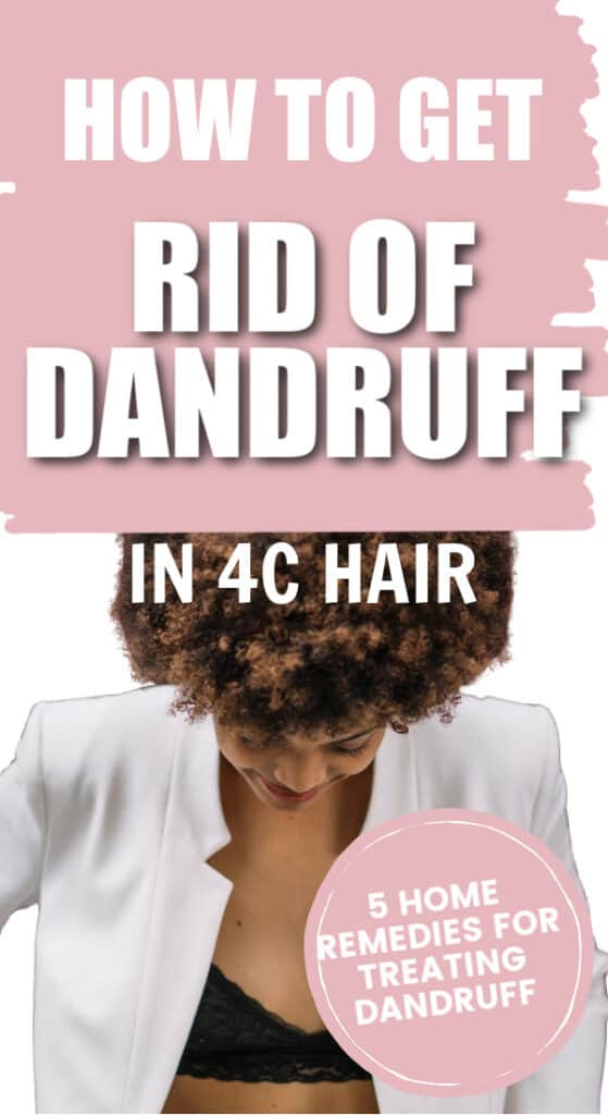 How to get rid of dandruff in 4c hair